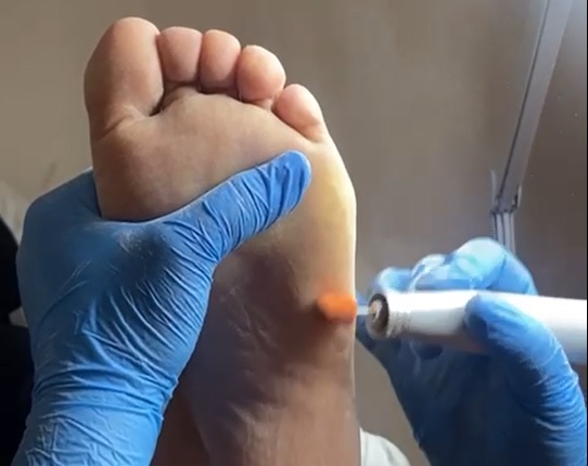  uygulamaları videosu önizleme